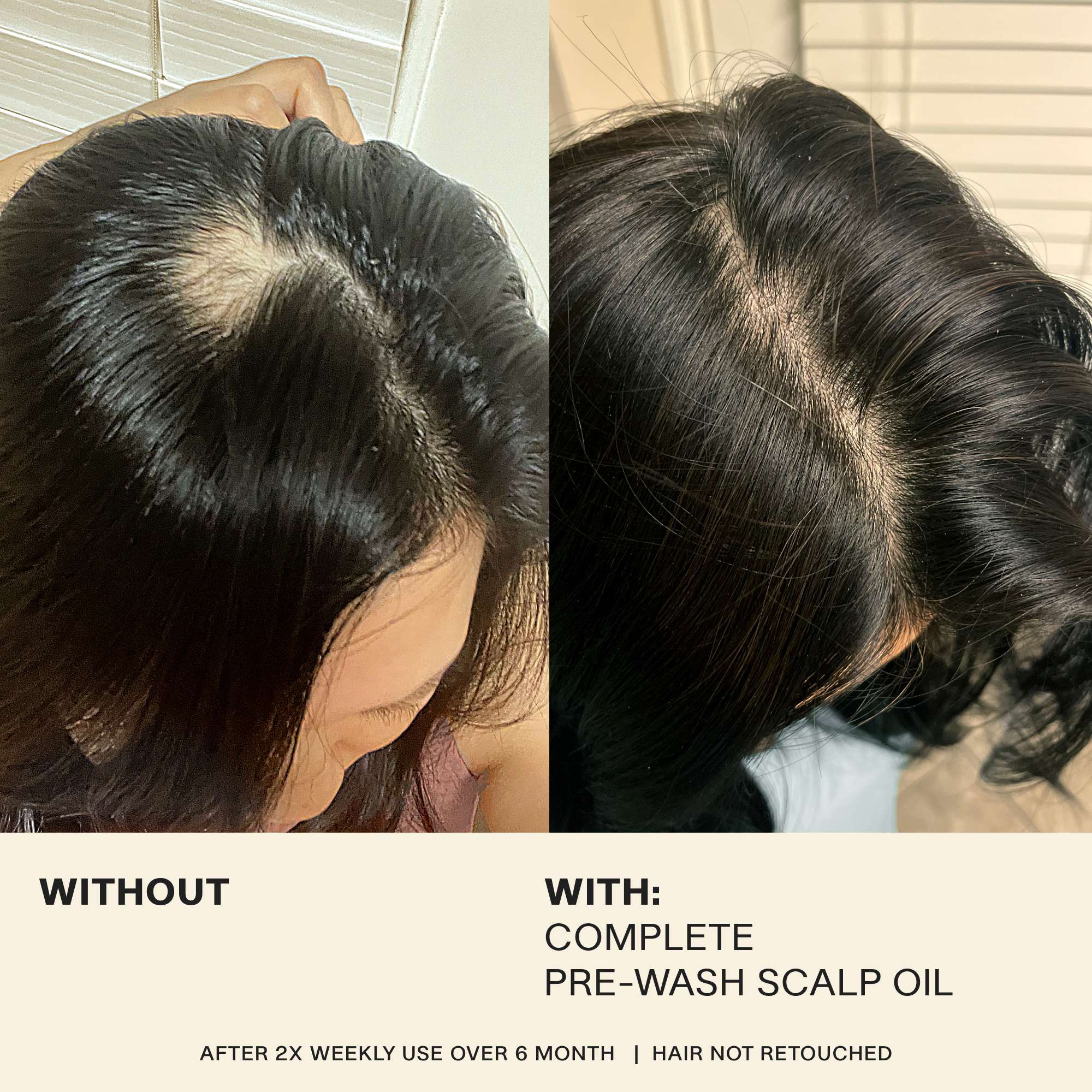 Complete Pre-Wash Scalp Oil Travel - Image 4