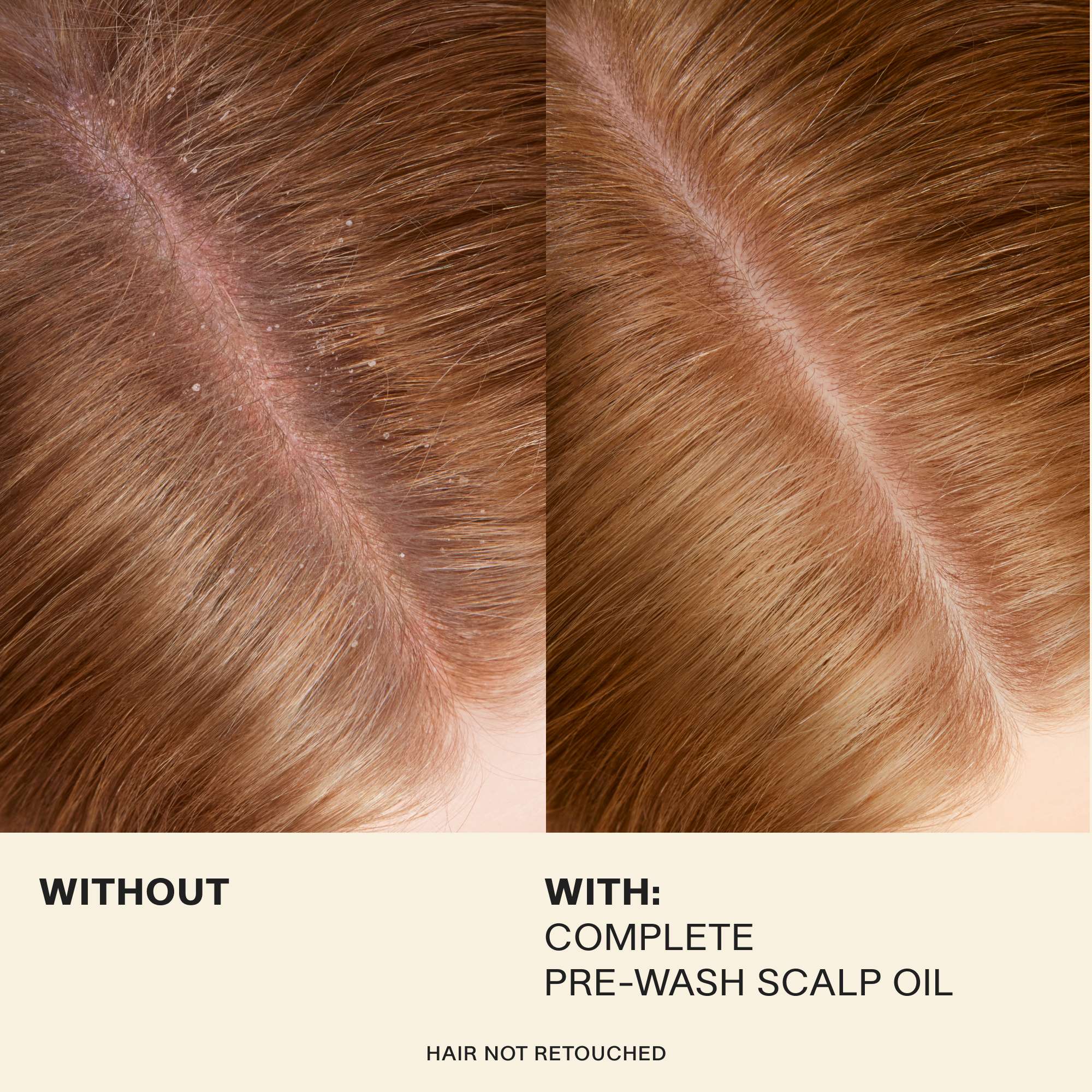 Complete Pre-Wash Scalp Oil Travel - Image 5